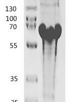 Escherichia coli Colicin-Ia (cia) (626:I→I-ASVKVSCKASGYTFTNYGMNWVKQAPGQGLKWMGWQQHYITPLTFGAGTKVEIK) Recombinant Protein - BioCrest Sci