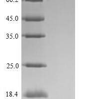 Mouse Roundabout homolog 1 (Robo1), partial Recombinant Protein, N-His-Myc - BioCrest Sci