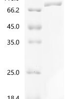 Human Propionyl-CoA carboxylase alpha chain, mitochondrial (PCCA) Recombinant Protein - BioCrest Sci