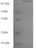 Human Zinc finger protein 155 (ZNF155) Recombinant Protein - BioCrest Sci
