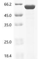 Mycobacterium tuberculosis Pup--protein ligase (pafA) Recombinant Protein - BioCrest Sci