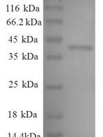 Human L-lactate dehydrogenase A chain (LDHA), partial Recombinant Protein, N-His - BioCrest Sci
