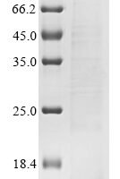 Avian infectious bronchitis virus Non-structural protein 5b (5b) Recombinant Protein - BioCrest Sci