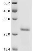 Human GTPase KRas (KRAS) Recombinant Protein, N-His - BioCrest Sci