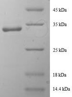 Human Tricarboxylate transport protein (SLC20A3), partial Recombinant Protein - BioCrest Sci