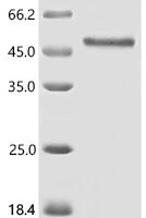 Human Eukaryotic translation initiation factor 4E (EIF4E) Recombinant Protein, N-GST - BioCrest Sci