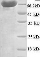 Human N-acetylmuramoyl-L-alanine amidase (PGLYRP2) Recombinant Protein - BioCrest Sci