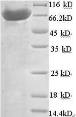 Human N-acetylmuramoyl-L-alanine amidase (PGLYRP2) Recombinant Protein, Homo sapiens (Human), E.coli, N-terminal 6xHis-SUMO-tagged, 76.0 kDa, purity >≥ 90% as determined by SDS-PAGE.