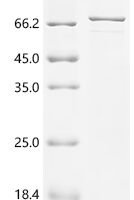 Human Lysosomal acid glucosylceramidase (GBA1) Recombinant Protein, N-His-SUMO - BioCrest Sci