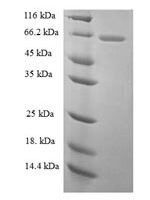 Rat Galectin-3-binding protein (Lgals3bp) Recombinant Protein - BioCrest Sci
