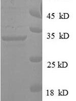Human t Pyrroline-5-carboxylate reductase 1, mitochondrial (PYCR1) Recombinant Protein - BioCrest Sci