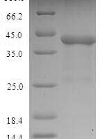 Phleum pratense Pollen allergen Phl p 1 (PHLPI) Recombinant Protein, N-His-SUMO - BioCrest Sci