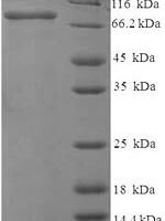 Rat 72 kDa type IV collagenase (Mmp2) Recombinant Protein, N-His-SUMO - BioCrest Sci
