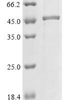 Neosartorya fumigata Probable pectate lyase C (plyC) Recombinant Protein, C-His - BioCrest Sci