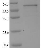 Porphyromonas gingivalis Lys-gingipain (kgp), partial Recombinant Protein, N-His-SUMO - BioCrest Sci