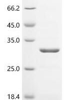 Human Immunoglobulin lambda-like polypeptide 5 (IGLL5) Recombinant Protein, N-His, aa 36–214, E.coli - BioCrest Sci
