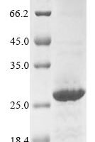 Human Neuronal acetylcholine receptor subunit alpha-3 (CHRNA3), partial Recombinant Protein, C-10His, aa 32–240, Baculovirus - BioCrest Sci