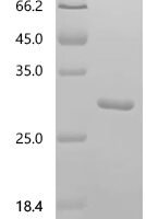 Mouse Dystrophin (Dmd), partial Recombinant Protein, C-His, aa 1–240, Mus musculus (Mouse) - BioCrest Sci