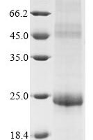 Human papillomavirus type 11 Replication protein E1 (E1), partial Recombinant Protein - BioCrest Sci