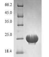 Mycobacterium tuberculosis Recombination protein RecR (recR) Recombinant Protein - BioCrest Sci