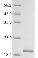 Rat Gamma-synuclein (Sncg) Recombinant Protein - BioCrest Sci
