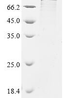 Human Mitochondrial antiviral-signaling protein (MAVS), partial Recombinant Protein, N-His-GST - BioCrest Sci