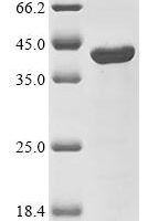 Human DNA repair endonuclease XPF (ERCC4), partial Recombinant Protein - BioCrest Sci