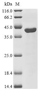 Human DNA repair endonuclease XPF (ERCC4), partial Recombinant Protein, Homo sapiens (Human), E.coli, C-terminal 6xHis-tagged, 35.6 kDa, purity >≥ 90% as determined by SDS-PAGE.