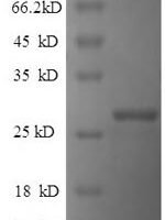 Human Reelin (RELN), partial Recombinant Protein - BioCrest Sci