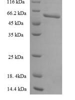 Human Urokinase plasminogen activator surface receptor (PLAUR) Recombinant Protein - BioCrest Sci