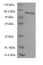 Human Urokinase plasminogen activator surface receptor (PLAUR) Recombinant Protein, Homo sapiens (Human), E.coli, N-terminal GST-tagged, 58.5 kDa, purity >≥ 90% as determined by SDS-PAGE.