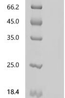 Artemisia vulgaris Profilin-1 Recombinant Protein, C-His, aa 2–133, Yeast - BioCrest Sci