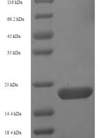 Human Aquaporin-4 (AQP4), partial Recombinant Protein, N-His-SUMO - BioCrest Sci