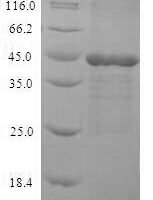 Human Mitogen-activated protein kinase 3 (MAPK3), partial Recombinant Protein - BioCrest Sci