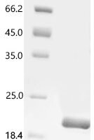 Mouse Apolipoprotein M (Apom) Recombinant Protein, C-His - BioCrest Sci
