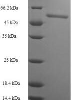 Human GMP reductase 2 (GMPR2) Recombinant Protein - BioCrest Sci