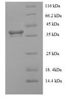 Human Heme-binding protein 2 (HEBP2) Recombinant Protein - BioCrest Sci