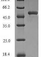 Human Dynactin subunit 1 (DCTN1), partial Recombinant Protein - BioCrest Sci