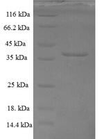 Drosophila melanogaster Bursicon (burs) Recombinant Protein, N-GST - BioCrest Sci