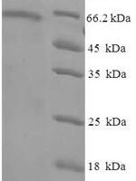Human Tubulin beta-6 chain (TUBB6) Recombinant Protein - BioCrest Sci