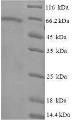 Human Tubulin beta-6 chain (TUBB6) Recombinant Protein, Homo sapiens (Human), E.coli, N-terminal 6xHis-SUMO-tagged, 65.9 kDa, purity >≥ 90% as determined by SDS-PAGE.