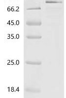 Human Interleukin-23 subunit alpha (IL23A) Recombinant Protein - BioCrest Sci