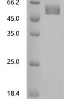 Mouse T-cell surface glycoprotein CD4 (Cd4), partial Recombinant Protein - BioCrest Sci