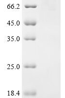 Klebsiella pneumoniae subsp. pneumoniae Chaperonin GroEL (groEL),Biotinylated Recombinant Protein - BioCrest Sci