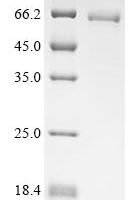 Human Taste receptor type 1 member 2 (TAS1R2), partial Recombinant Protein, N-10His/C-Myc - BioCrest Sci