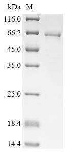 Human Taste receptor type 1 member 2 (TAS1R2), partial Recombinant Protein, N-10His/C-Myc, Homo sapiens (Human), E.coli, N-terminal 10xHis-tagged and C-terminal Myc-tagged, 67.6 kDa, purity >≥ 85% as determined by SDS-PAGE.