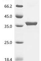 Escherichia coli Sugar phosphatase YidA (yidA) Recombinant Protein - BioCrest Sci