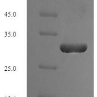 Escherichia coli Thioredoxin-2 (trxC) Recombinant Protein, N-His-SUMO - BioCrest Sci