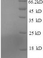Mouse Guanylate cyclase activator 2B (Guca2b) Recombinant Protein, N-GST - BioCrest Sci