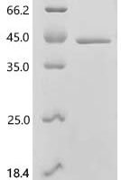 Saccharomyces cerevisiae Homeobox protein CUP9 (CUP9) Recombinant Protein - BioCrest Sci